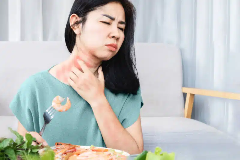 woman having an allergic response to shellfish